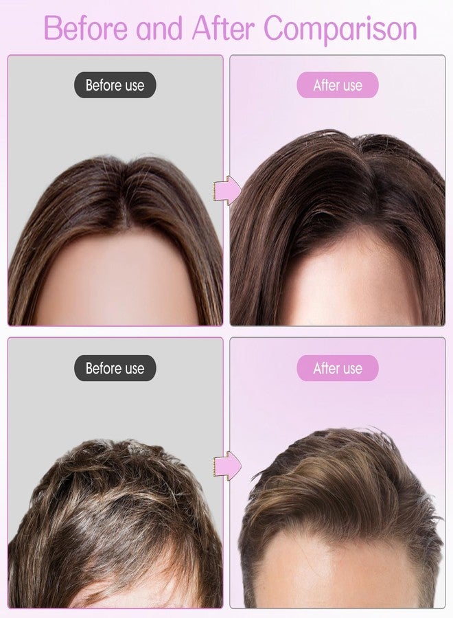 JANFUN Volumizing Hair Clips for Women 2PCS, Hair Volume Clip Styling Tools Volumizing Comb for Fluffy Bangs Clips for Root Lift, Root Booster Clips - Image 5